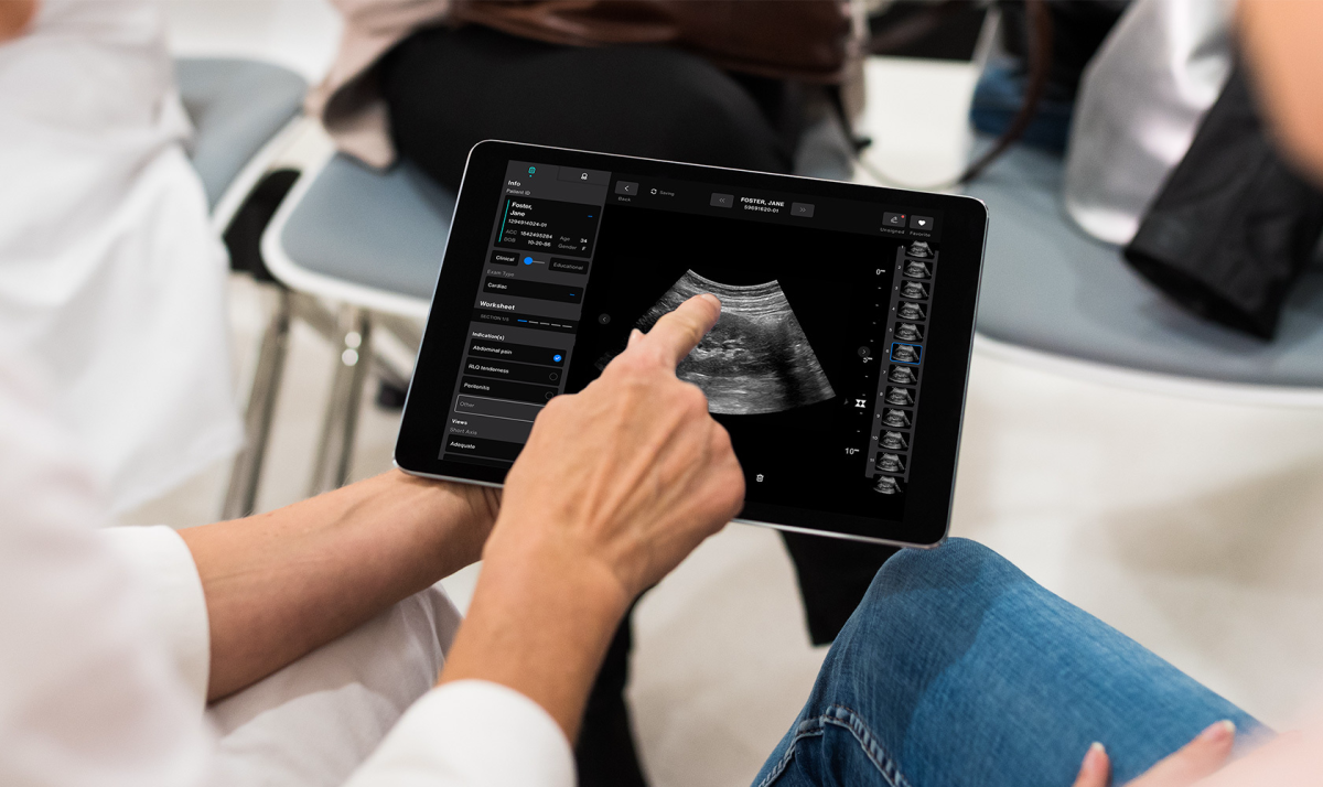 Samsung may invest in $100M round for medical imaging startup Exo
